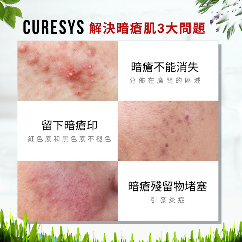 CURESYS -  蘋果醋消炎去暗瘡爽膚水 (300毫升)